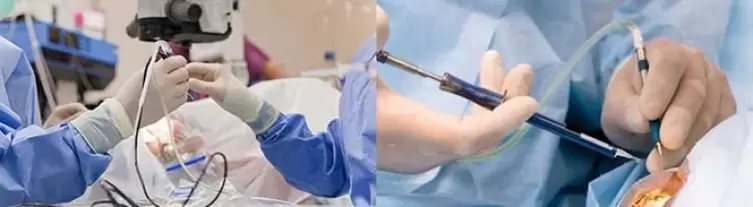 Operation zur Wiederherstellung der Sehkraft.